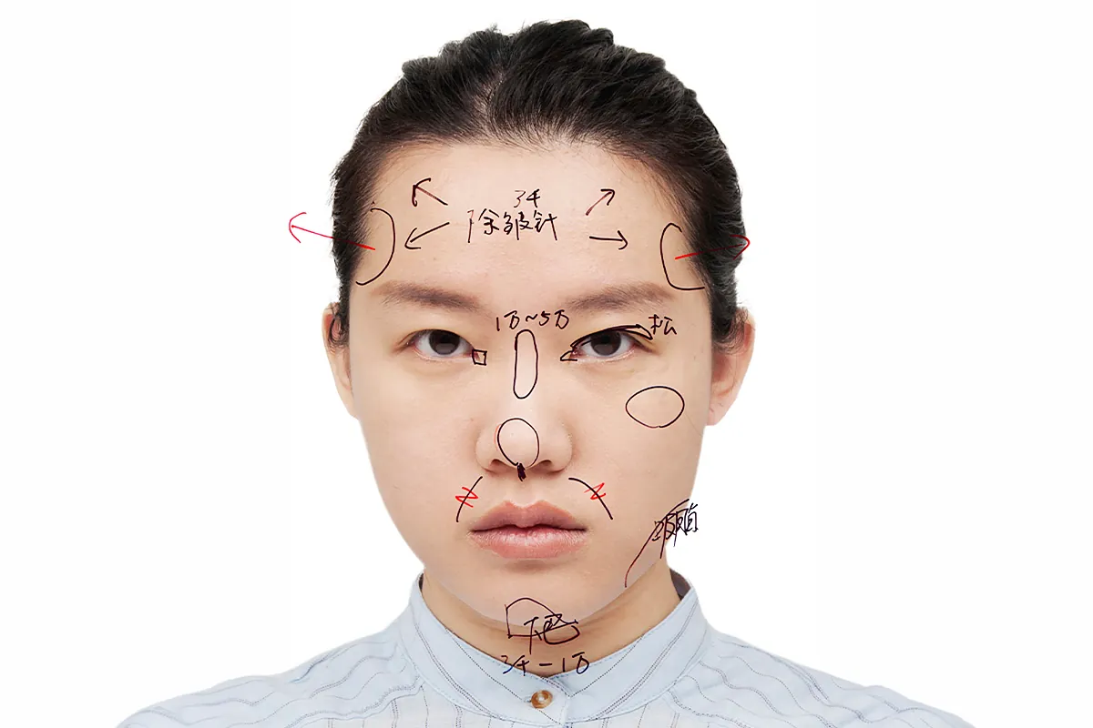 La fotógrafa china que recorrió 30 clínicas de estética: "Te sientes como en un supermercado eligiendo entre diferentes marcas del mismo producto"