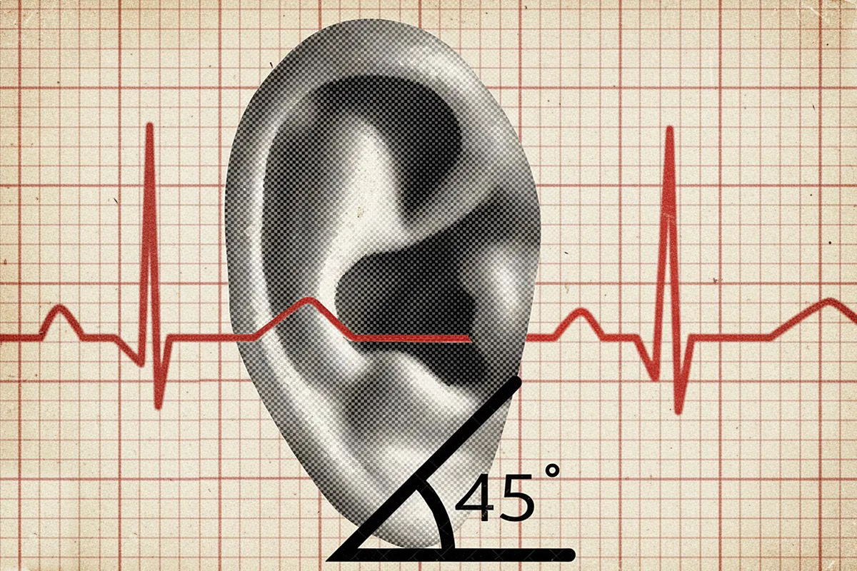 La marca en la oreja que puede predecir el infarto y que tiene Leonardo DiCaprio