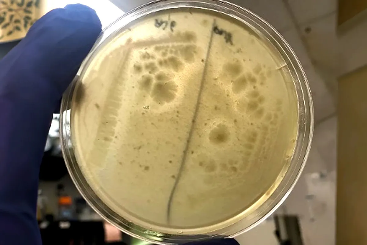 Una bacteria de la saliva 'protege' de la alergia al cacahuete, destruyendo en la boca las proteínas dañinas
