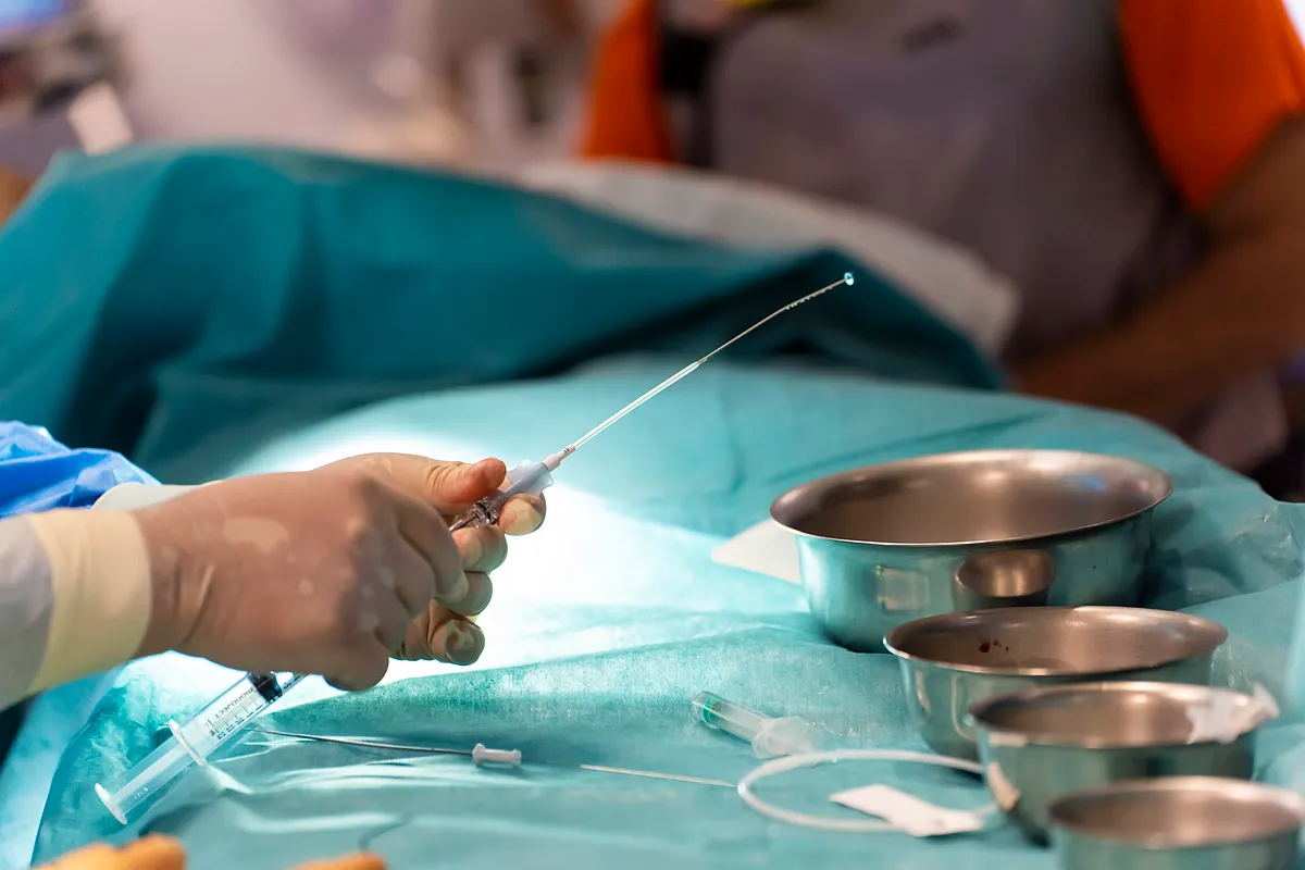 Una ola de especialistas de hospital de diferentes puntos de España dejarán de hacer de horas extras para operar a partir del día 1