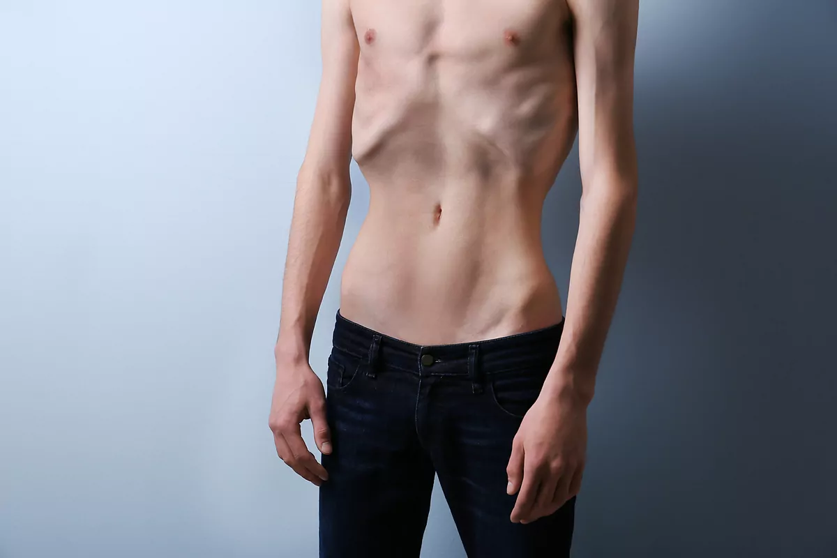 Ortorexia, permarexia o alcohorexia: los trastornos de la conducta alimentaria no específicos ya casi doblan a la bulimia y la anorexia nerviosa tradicionales