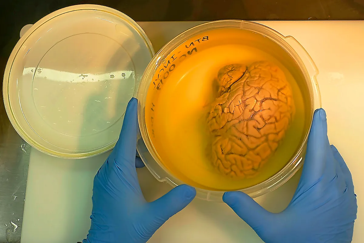 Decodifican las 'tuberías del cerebro': el líquido cefalorraquídeo, clave para entender y combatir los tumores