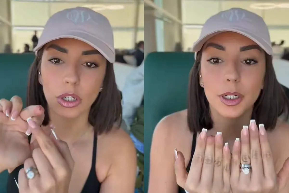 Anita Williams muestra su dedo amputado tras su accidente en GH Dúo: "Tuvieron que limarme el hueso"