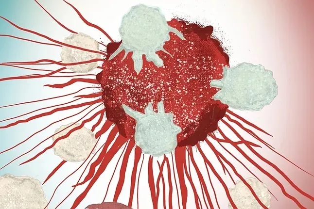 Las defensas entrenadas atacan el "castillo" de los tumores sólidos: las terapias CAR-T encuentran debilidades en el riñón, ovario y páncreas