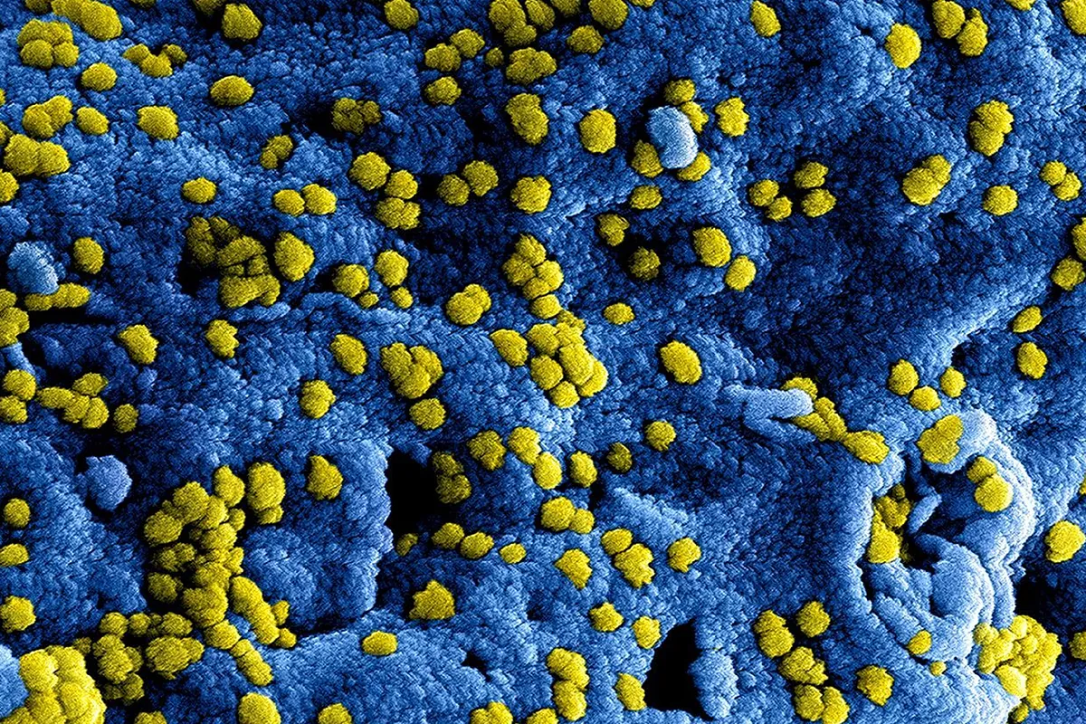 Una IA diseña los primeros virus completos capaces de replicarse en el laboratorio
