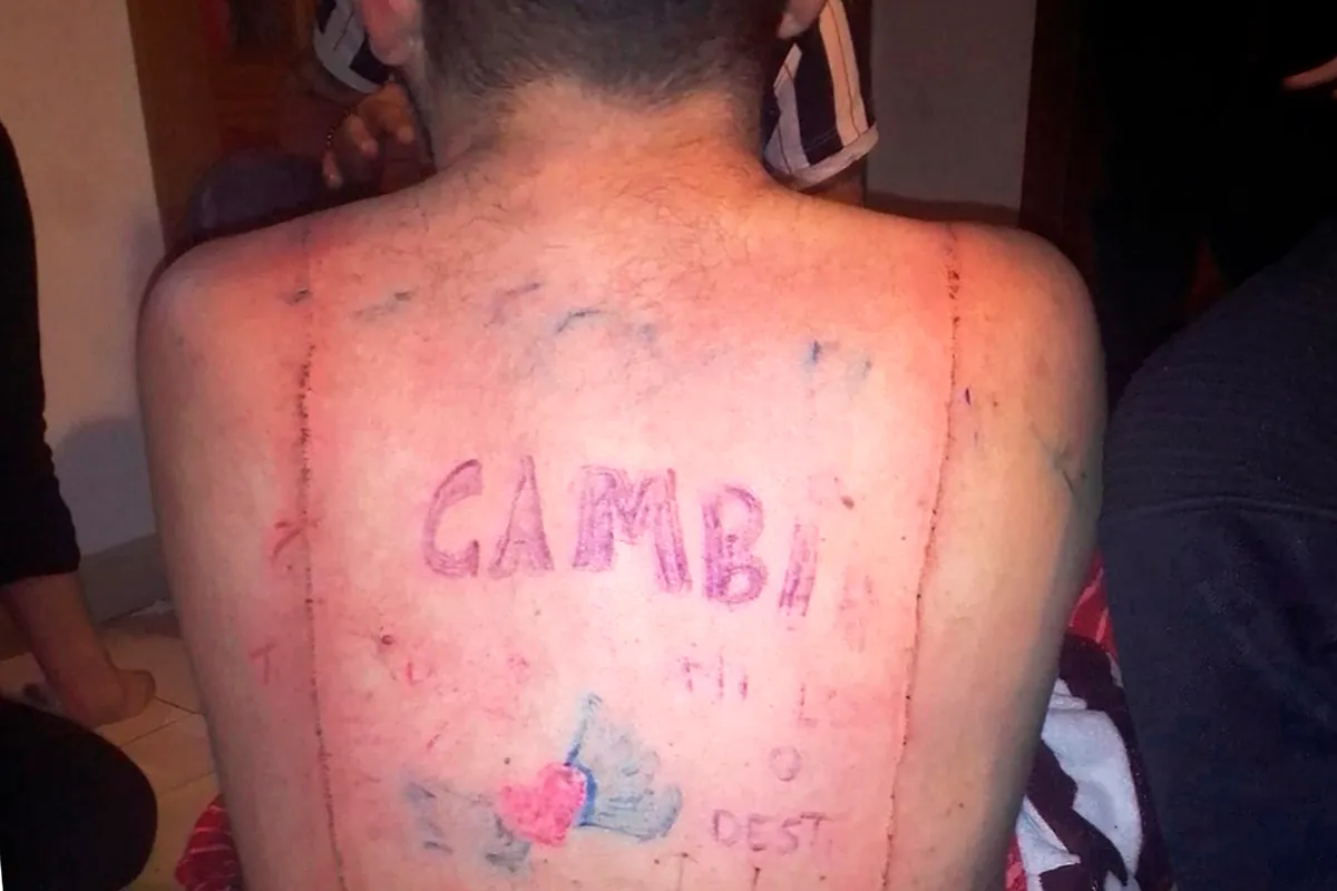 Seis condenados por tatuar un pene en la cara y someter a diversas vejaciones a un joven con discapacidad en Manacor