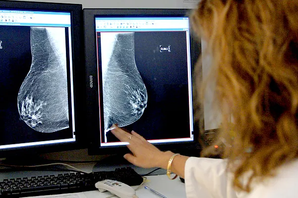 Sanidad aprueba la ampliación del cribado de cáncer de mama a mujeres de entre 45 y 74 años