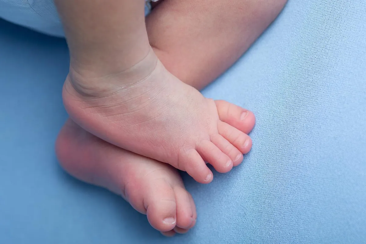Madrid amplía de 23 a 35 las patologías del programa de cribado neonatal