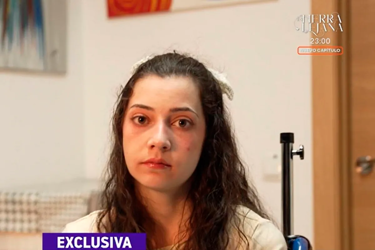 La Fiscalía avala que un familiar pueda recurrir en los tribunales una eutanasia si hay "un intenso vínculo afectivo"