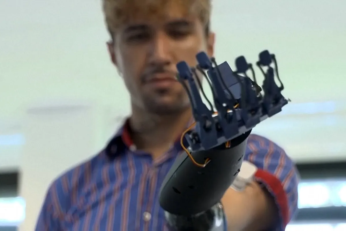 Así es la prótesis E-Redi: biónica, sencilla y fácil de usar. ¿El futuro de gadgets biónicos?