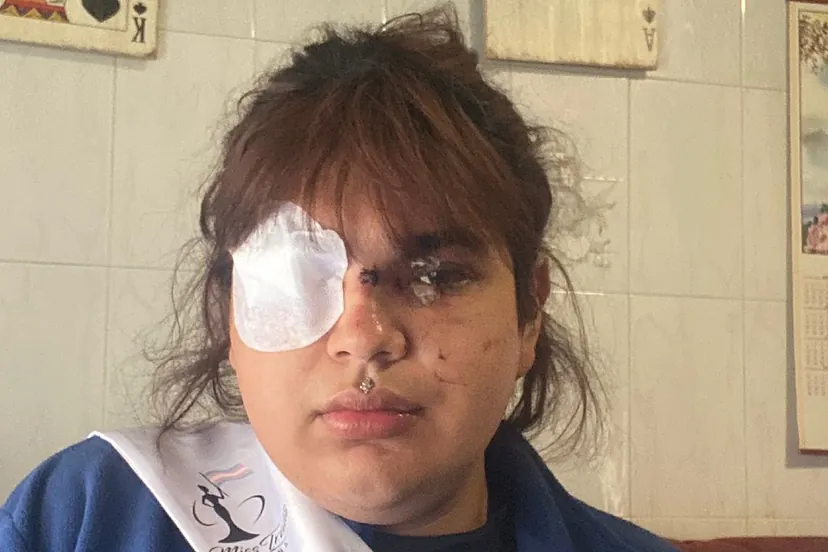 Bianca, Miss Trans Zamora, tras la agresión: "Está todavía con mucho miedo,  porque hubo un momento en que se vio muerta"