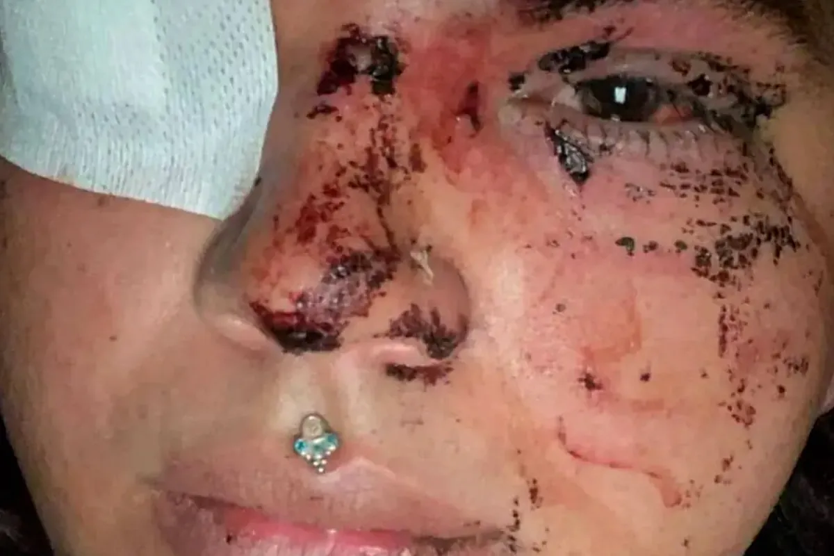 Brutal paliza a Miss Trans Zamora en por un grupo de personas en La Bañeza (León): "Alcemos la voz"