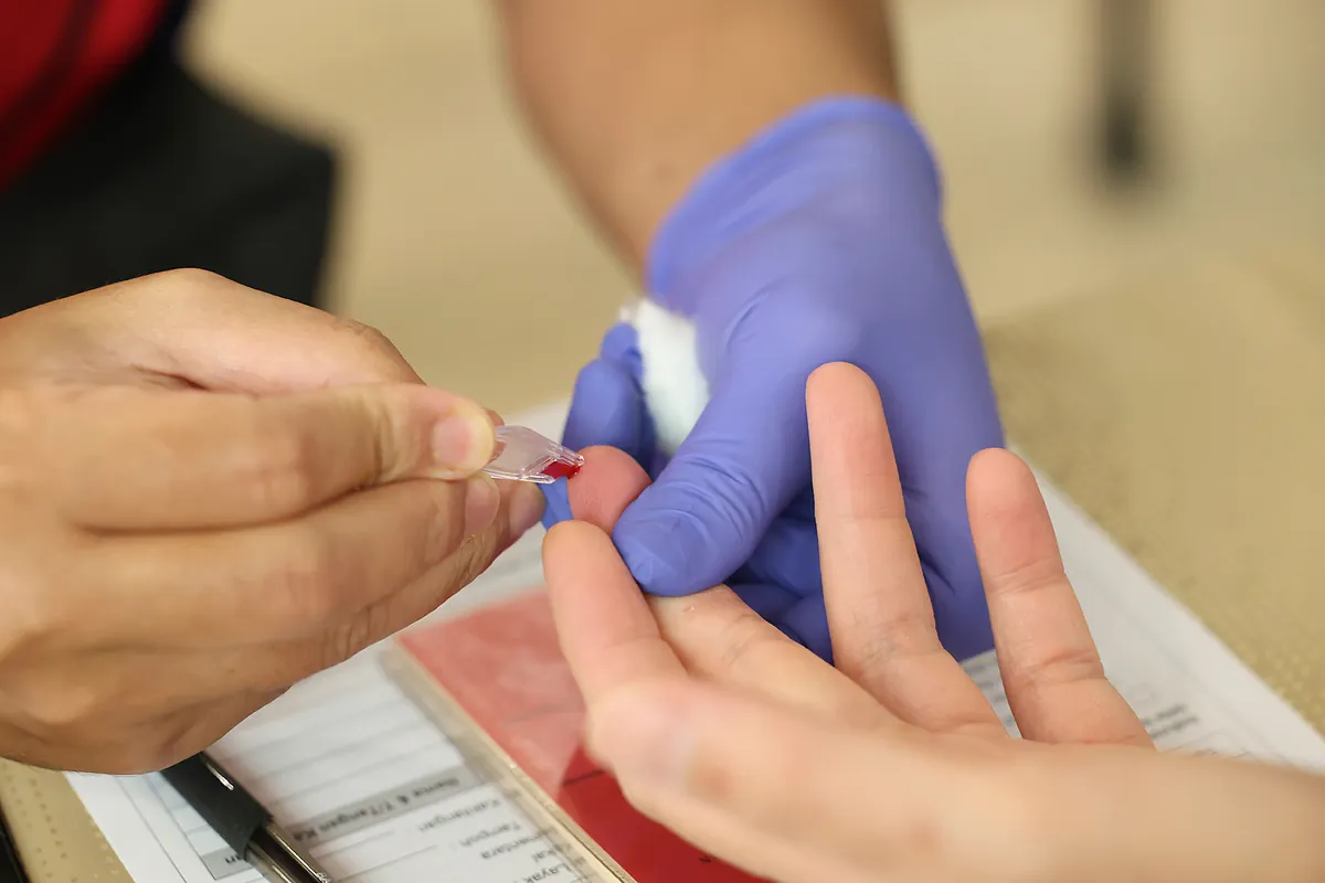 Diseñan un método que detecta el alzhéimer con una sola gota de sangre seca