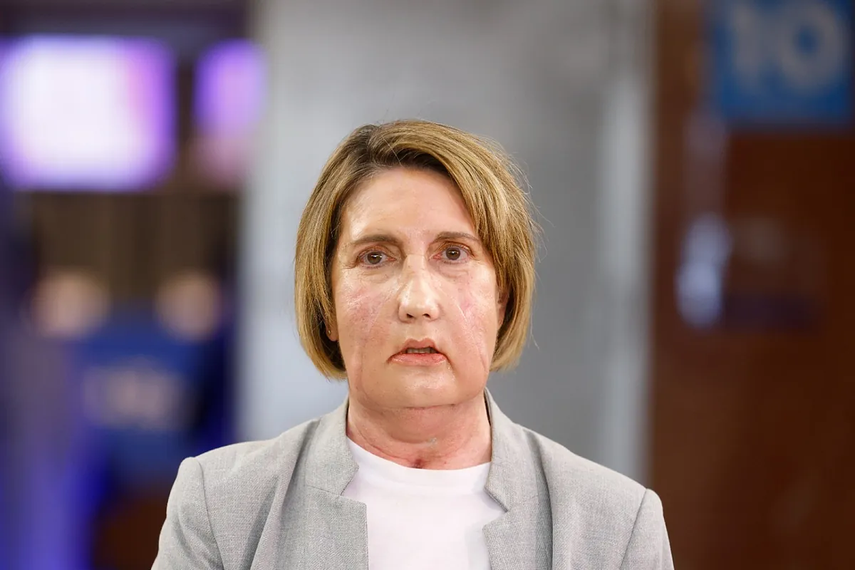 El Hospital Vall d Hebron de Barcelona realiza el primer trasplante de cara con donación procedente de eutanasia