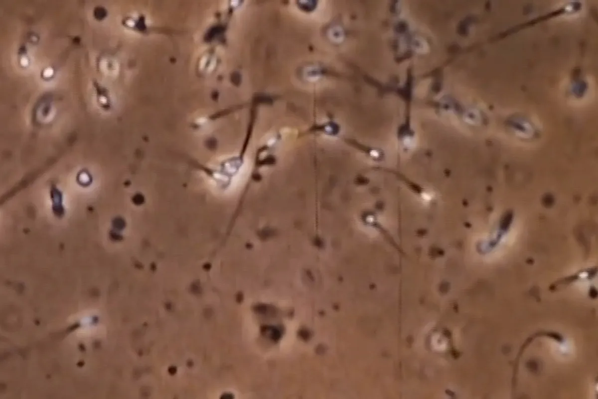 Eyacular una vez al día podría mejorar la calidad del esperma