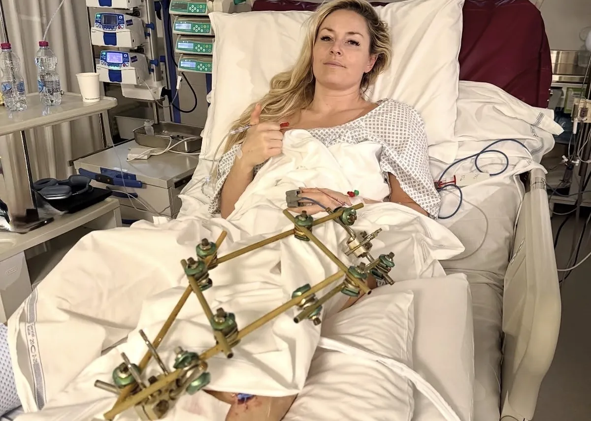 La impactante imagen de Lindsey Vonn en el hospital tras la "exitosa" operación de su pierna fracturada: "Sé que estaré bien"